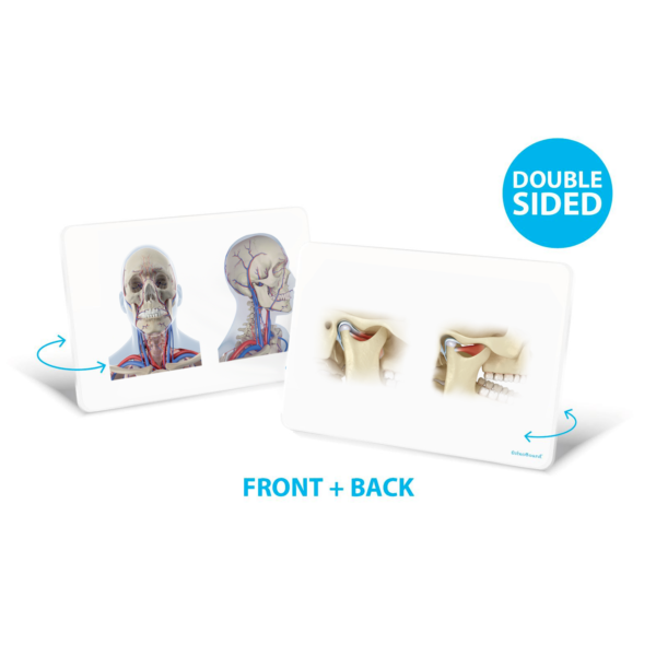 OsteoBoard TMJ