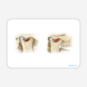 OsteoBoard TMJ